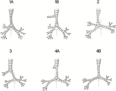 Morphologic classification of tracheobronchial arborization in children with congenital tracheobronchial stenosis and the associated cardiovascular defects